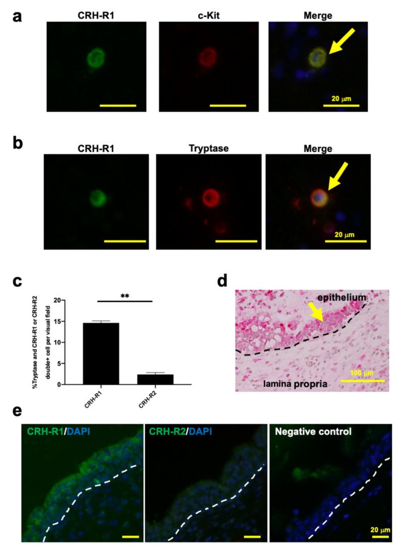 https://cdn.ncbi.nlm.nih.gov/pmc/blobs/97c5/7967145/23b0491f96eb/ijms-22-02773-g001.jpg