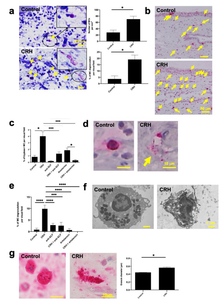 https://cdn.ncbi.nlm.nih.gov/pmc/blobs/97c5/7967145/554466fa5aab/ijms-22-02773-g002.jpg