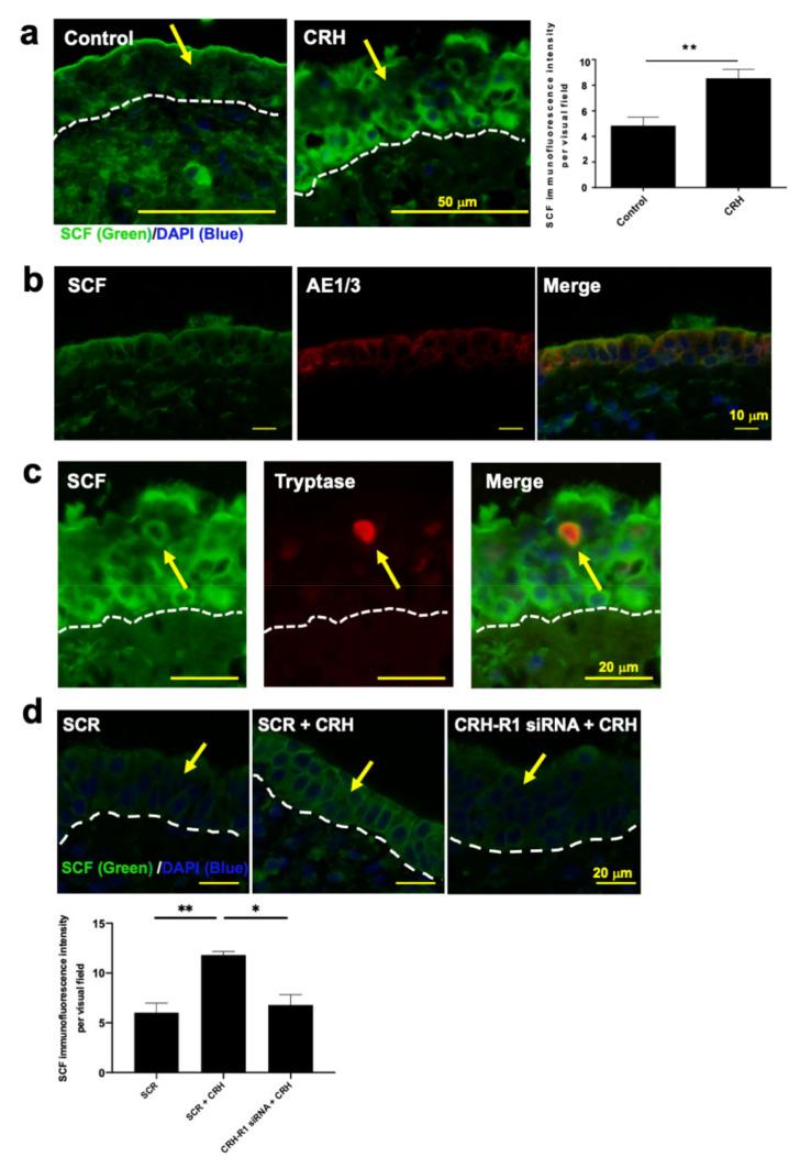 https://cdn.ncbi.nlm.nih.gov/pmc/blobs/97c5/7967145/cbedfc8e6071/ijms-22-02773-g004.jpg