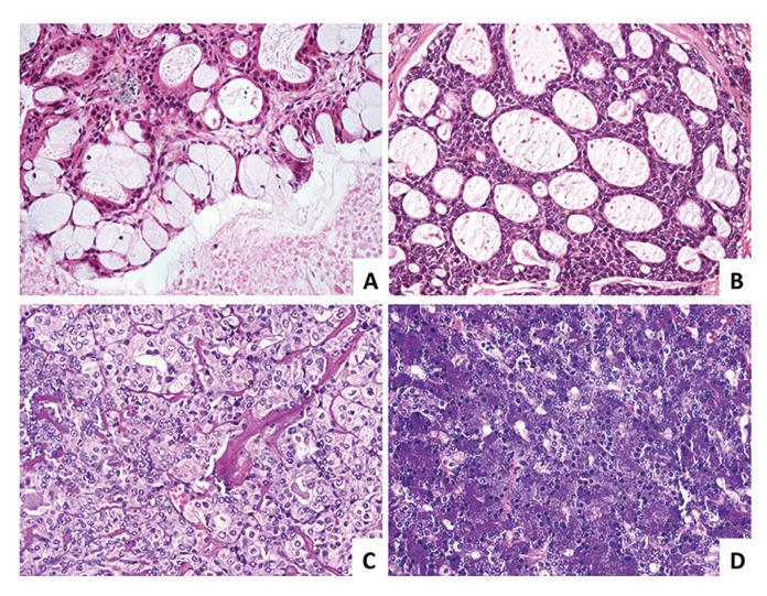 https://cdn.ncbi.nlm.nih.gov/pmc/blobs/97c6/8141320/a5c335254a9b/medoral-26-e393-g002.jpg
