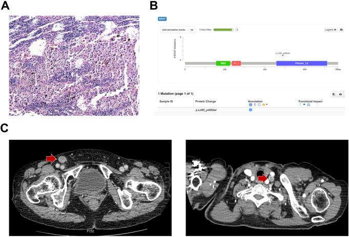 https://cdn.ncbi.nlm.nih.gov/pmc/blobs/97cc/9853440/cfe9a7d0ce76/fphar-13-1019217-g001.jpg