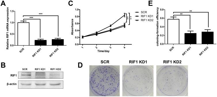 https://cdn.ncbi.nlm.nih.gov/pmc/blobs/97d3/5739795/1bb191706c9b/oncotarget-08-107044-g002.jpg