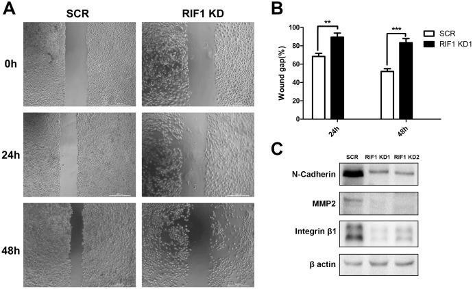 https://cdn.ncbi.nlm.nih.gov/pmc/blobs/97d3/5739795/d333e6292d0d/oncotarget-08-107044-g004.jpg