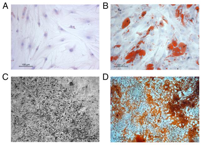 https://cdn.ncbi.nlm.nih.gov/pmc/blobs/97d8/9647781/6fb3d0b6cbc8/ol-24-06-13570-g00.jpg