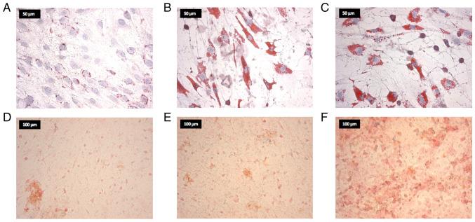 https://cdn.ncbi.nlm.nih.gov/pmc/blobs/97d8/9647781/b458d92264c8/ol-24-06-13570-g03.jpg