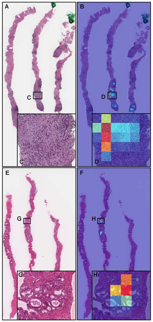 https://cdn.ncbi.nlm.nih.gov/pmc/blobs/97f2/8947489/1943f2e2dad4/diagnostics-12-00768-g004.jpg