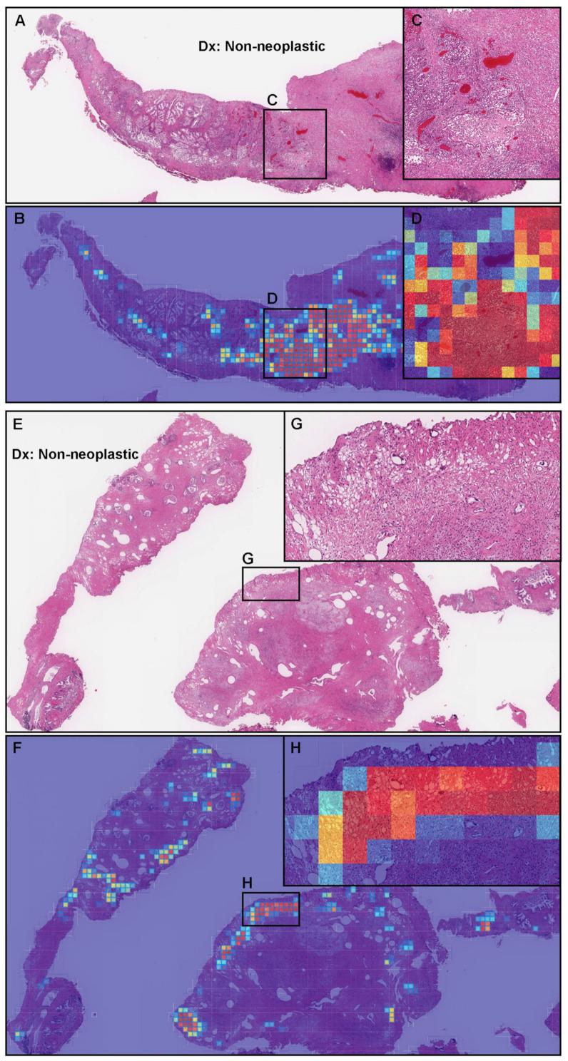 https://cdn.ncbi.nlm.nih.gov/pmc/blobs/97f2/8947489/2313d8cfe40e/diagnostics-12-00768-g007.jpg