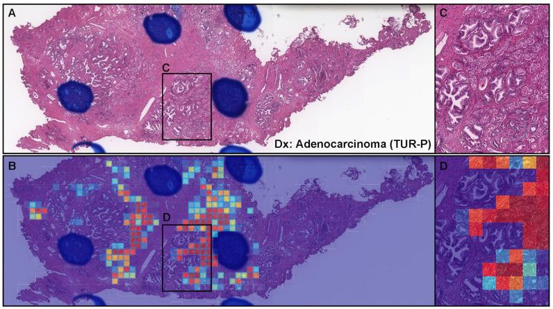 https://cdn.ncbi.nlm.nih.gov/pmc/blobs/97f2/8947489/47630817417d/diagnostics-12-00768-g006.jpg