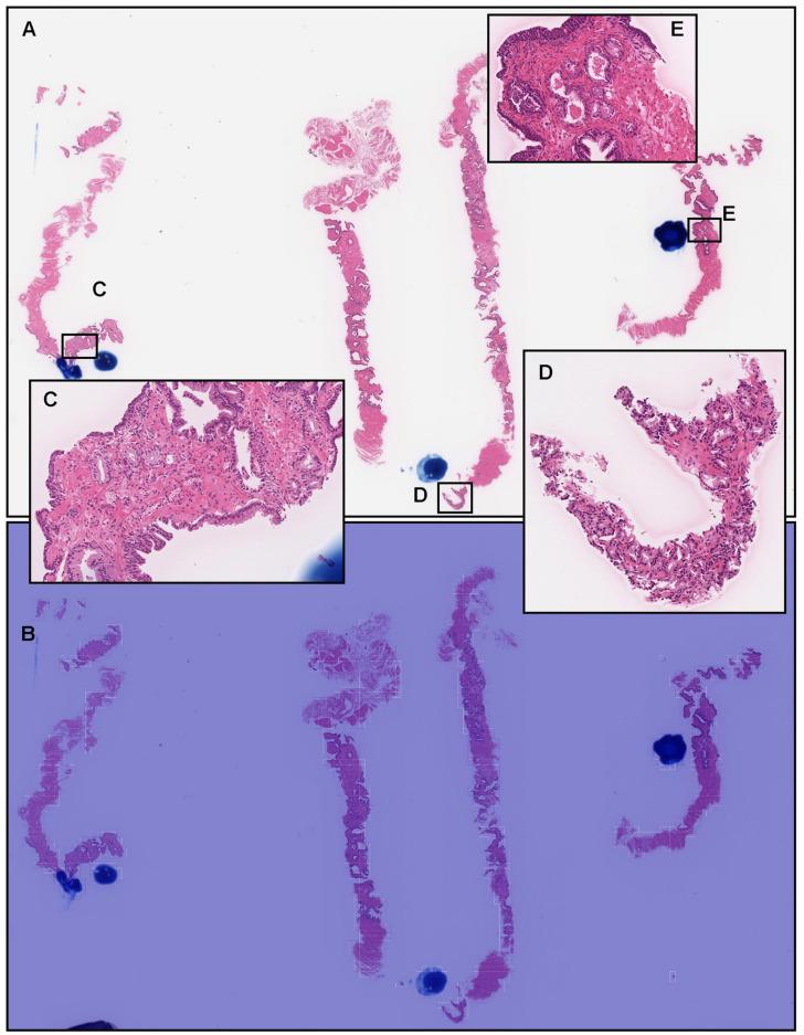 https://cdn.ncbi.nlm.nih.gov/pmc/blobs/97f2/8947489/593f555b7993/diagnostics-12-00768-g005.jpg