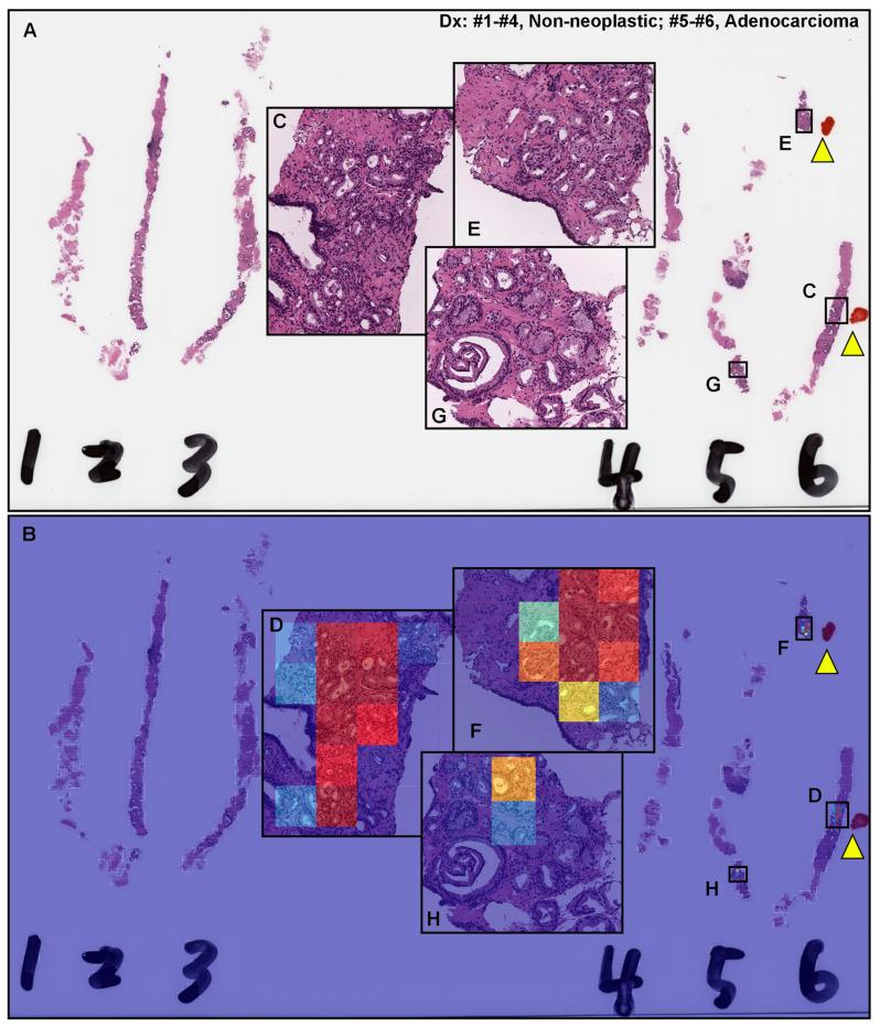 https://cdn.ncbi.nlm.nih.gov/pmc/blobs/97f2/8947489/7199a3b9b2b4/diagnostics-12-00768-g003.jpg