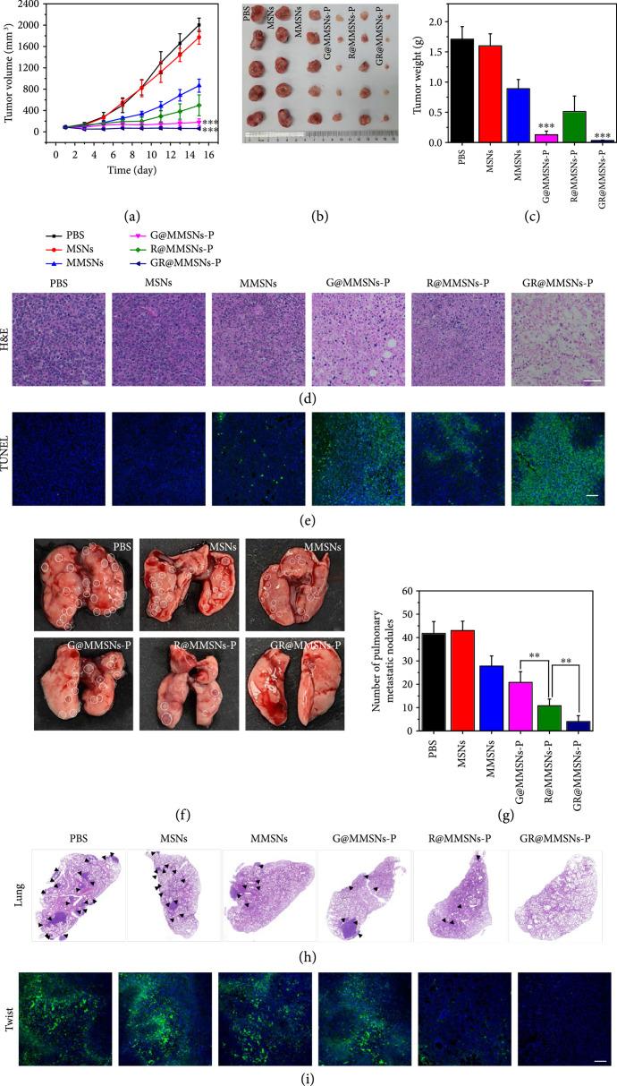 https://cdn.ncbi.nlm.nih.gov/pmc/blobs/97f9/11014676/486e00dc0871/9760398.fig.007.jpg