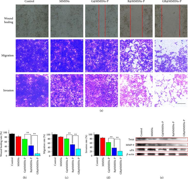 https://cdn.ncbi.nlm.nih.gov/pmc/blobs/97f9/11014676/ef55426281e2/9760398.fig.005.jpg