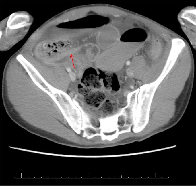 https://cdn.ncbi.nlm.nih.gov/pmc/blobs/97fd/4756184/95d759bfa578/gr3.jpg