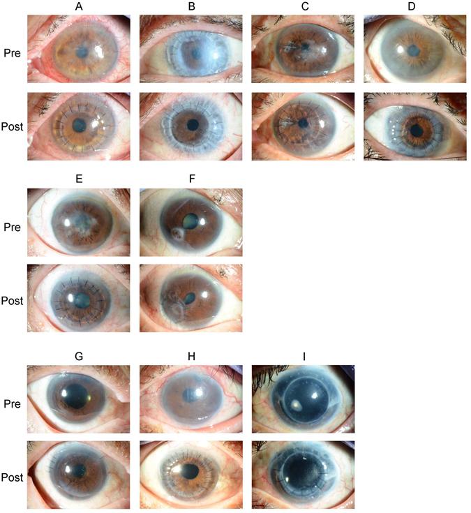 https://cdn.ncbi.nlm.nih.gov/pmc/blobs/9801/5519589/98a60ae488f2/41598_2017_6344_Fig1_HTML.jpg