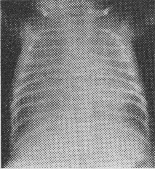 https://cdn.ncbi.nlm.nih.gov/pmc/blobs/980a/1991260/47cfc4828031/brmedj02091-0053-a.jpg