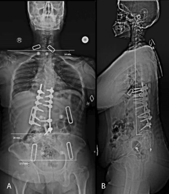 https://cdn.ncbi.nlm.nih.gov/pmc/blobs/980c/12318831/4a8c9c9681f4/CCR3-13-e70675-g001.jpg