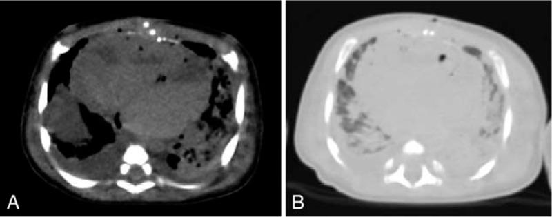 https://cdn.ncbi.nlm.nih.gov/pmc/blobs/980f/7220630/387e729c89ce/medi-99-e20130-g003.jpg