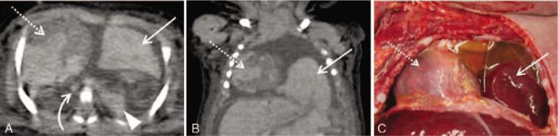 https://cdn.ncbi.nlm.nih.gov/pmc/blobs/980f/7220630/5c391757141b/medi-99-e20130-g002.jpg