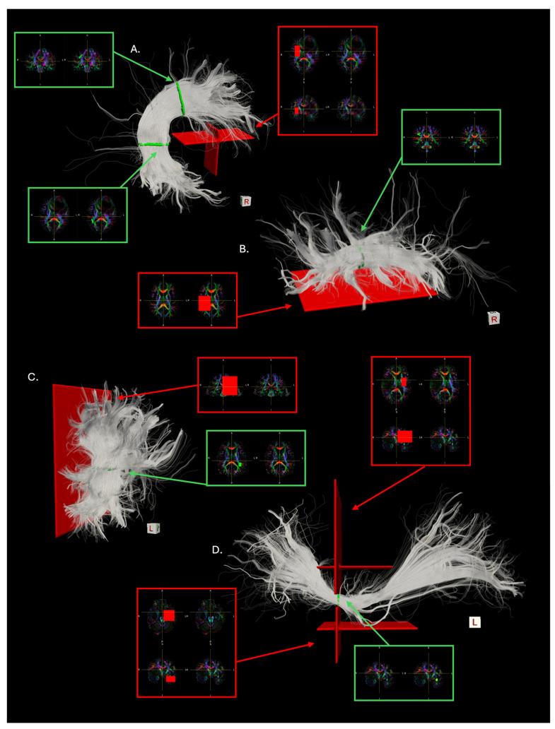 https://cdn.ncbi.nlm.nih.gov/pmc/blobs/9810/11727544/039a38567a6e/brainsci-14-01232-g001.jpg