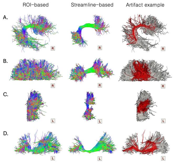 https://cdn.ncbi.nlm.nih.gov/pmc/blobs/9810/11727544/f1def390e266/brainsci-14-01232-g004.jpg