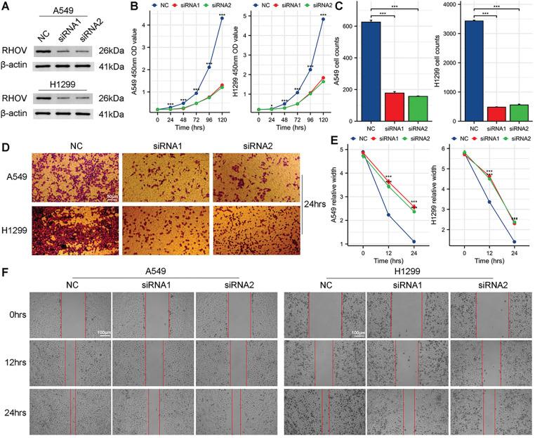 https://cdn.ncbi.nlm.nih.gov/pmc/blobs/9824/12144629/b4ef765acf23/OncolRes-33-62584-f011.jpg