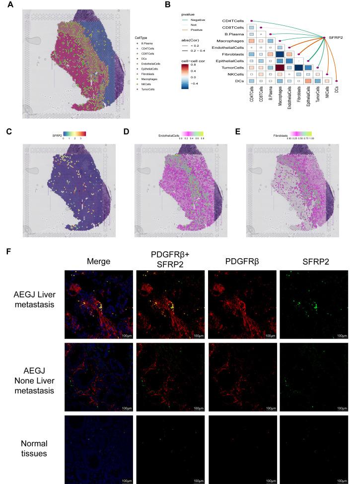 https://cdn.ncbi.nlm.nih.gov/pmc/blobs/9828/11754270/63035f05abb1/fimmu-15-1484234-g010.jpg