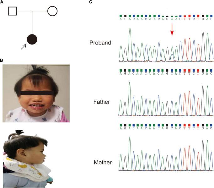 https://cdn.ncbi.nlm.nih.gov/pmc/blobs/982a/9490002/5dcb3f630b22/fnins-16-980000-g001.jpg