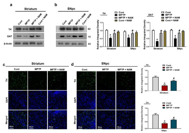 https://cdn.ncbi.nlm.nih.gov/pmc/blobs/982e/9687839/87dcb8ccf0b7/biomedicines-10-02929-g004.jpg
