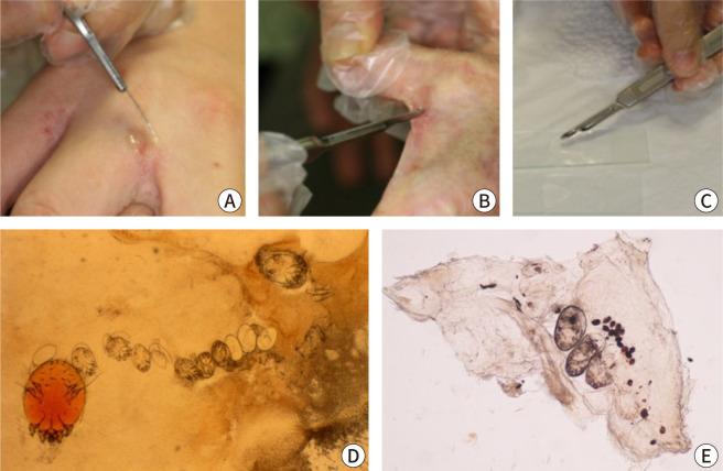 https://cdn.ncbi.nlm.nih.gov/pmc/blobs/9835/12093540/1cda76098673/emj-47-4-72-g4.jpg