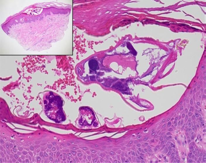 https://cdn.ncbi.nlm.nih.gov/pmc/blobs/9835/12093540/266e4e8e2ead/emj-47-4-72-g6.jpg