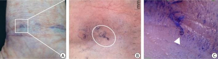 https://cdn.ncbi.nlm.nih.gov/pmc/blobs/9835/12093540/a9ad80caf6e9/emj-47-4-72-g3.jpg