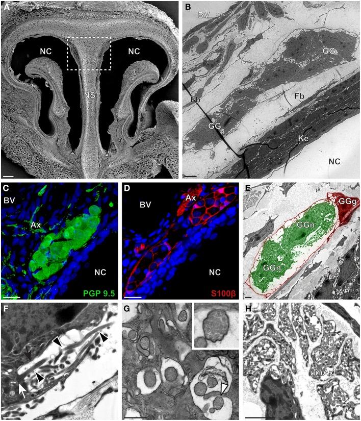 https://cdn.ncbi.nlm.nih.gov/pmc/blobs/9839/4145810/bc6779009991/fnana-08-00087-g0004.jpg
