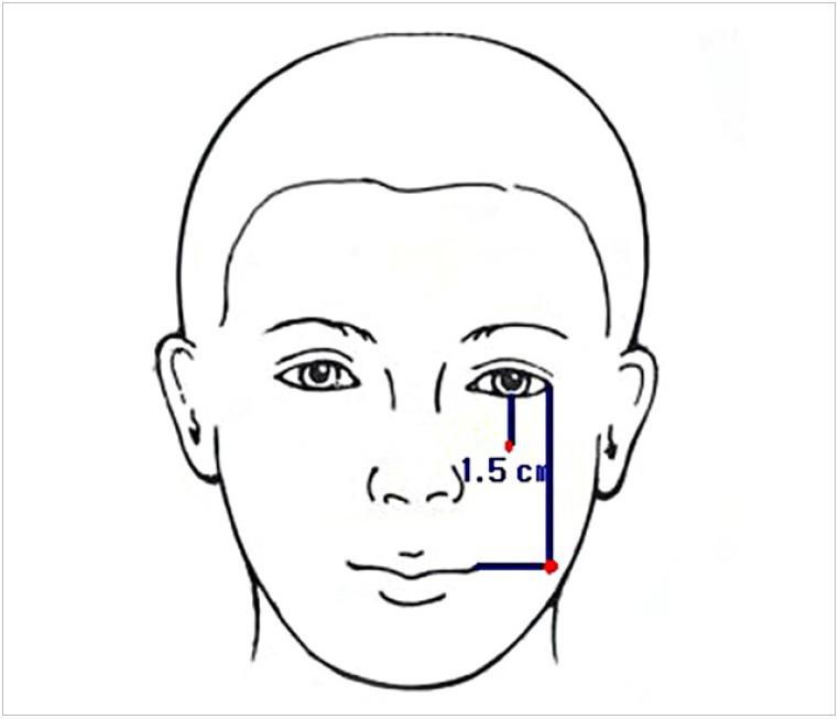 https://cdn.ncbi.nlm.nih.gov/pmc/blobs/983e/6615427/0e8df82d4994/acfs-2019-00213f2.jpg