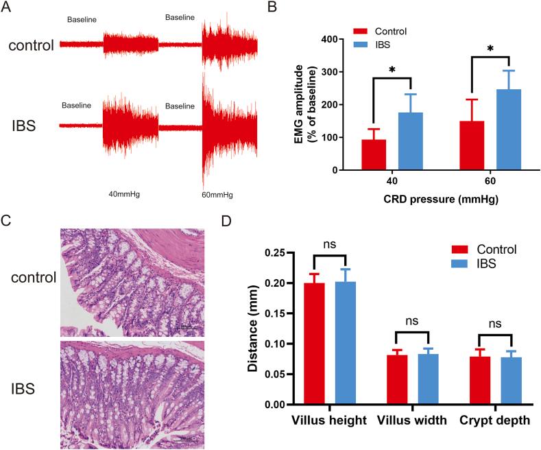 https://cdn.ncbi.nlm.nih.gov/pmc/blobs/983f/10440515/6ce76b660759/gr1.jpg