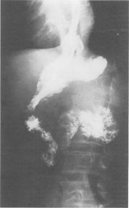https://cdn.ncbi.nlm.nih.gov/pmc/blobs/9840/1344262/46652fec0249/annsurg00280-0039-a.jpg