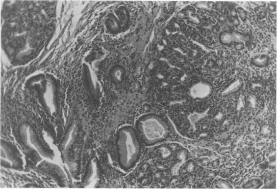 https://cdn.ncbi.nlm.nih.gov/pmc/blobs/9840/1344262/8cb632cd92fc/annsurg00280-0041-a.jpg