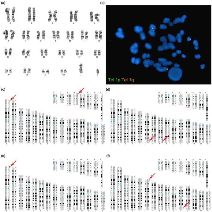 https://cdn.ncbi.nlm.nih.gov/pmc/blobs/9844/10795077/65a68c7ce0f1/MGG3-12-e2356-g002.jpg