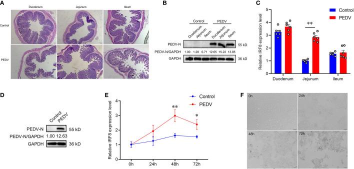https://cdn.ncbi.nlm.nih.gov/pmc/blobs/9846/10427914/636e1e5962f9/fimmu-14-1187144-g001.jpg