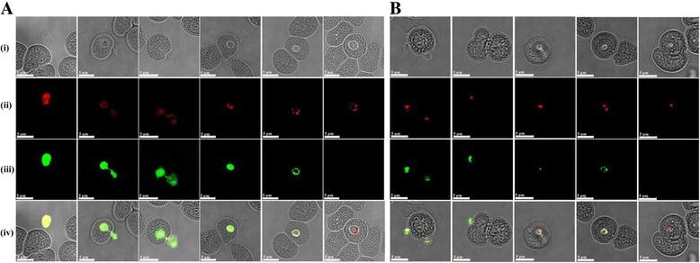 https://cdn.ncbi.nlm.nih.gov/pmc/blobs/9847/4855366/a75837f35ced/13071_2016_1518_Fig4_HTML.jpg