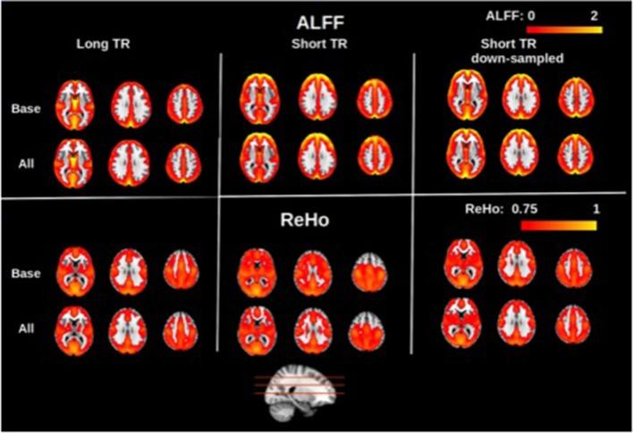 https://cdn.ncbi.nlm.nih.gov/pmc/blobs/9859/5633680/6de4bff5c887/fnins-11-00546-g0001.jpg