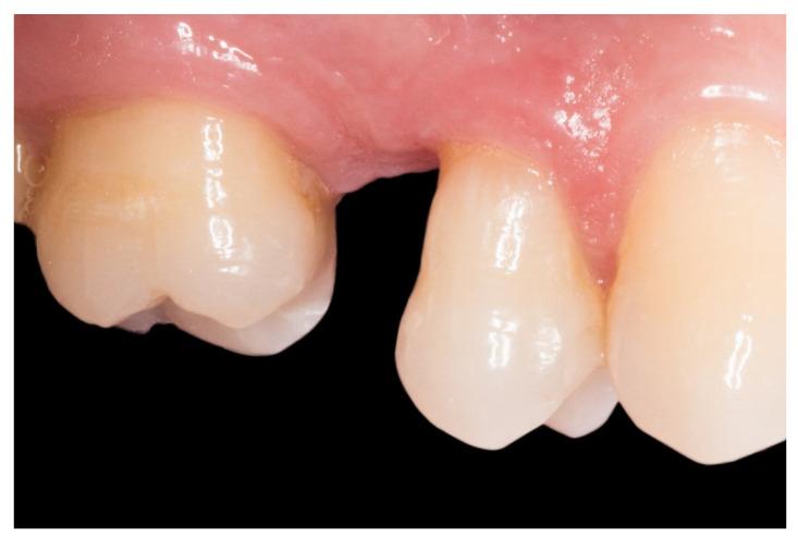 https://cdn.ncbi.nlm.nih.gov/pmc/blobs/985c/7344840/49eae738631c/dentistry-08-00048-g001.jpg