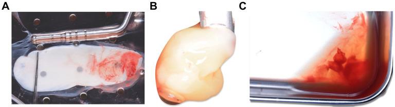 https://cdn.ncbi.nlm.nih.gov/pmc/blobs/9861/10673335/4617b359d63b/medicina-59-01903-g002.jpg