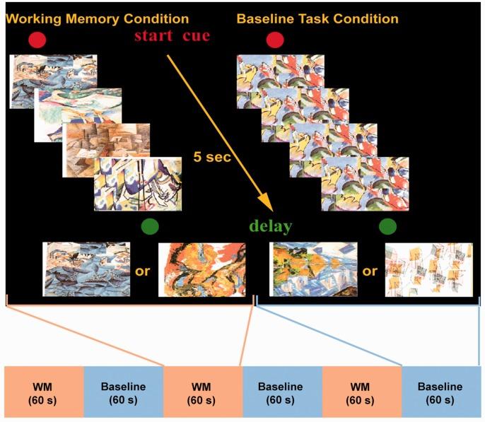 https://cdn.ncbi.nlm.nih.gov/pmc/blobs/986d/5466147/3f4fef0fdc85/10.1177_2055217317690561-fig4.jpg