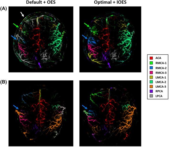 https://cdn.ncbi.nlm.nih.gov/pmc/blobs/9870/12309872/e55e30507269/MRM-94-1415-g003.jpg