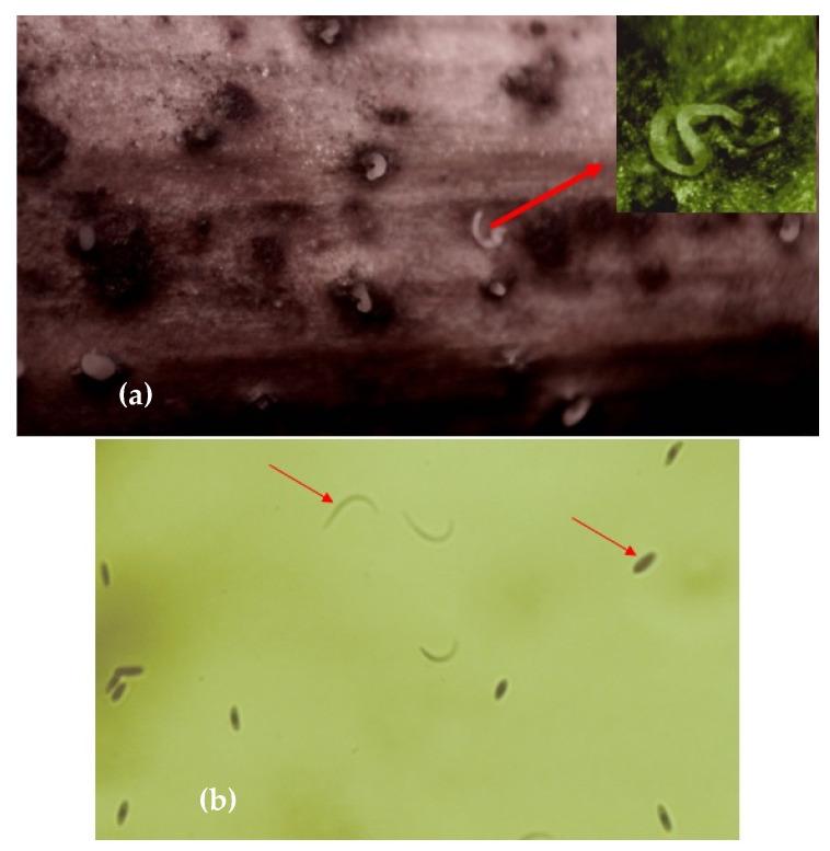 https://cdn.ncbi.nlm.nih.gov/pmc/blobs/9870/9503734/97217b67ac7a/pathogens-11-01006-g006.jpg