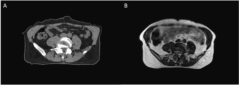 https://cdn.ncbi.nlm.nih.gov/pmc/blobs/987d/10788412/773284eb9cb9/gr2.jpg