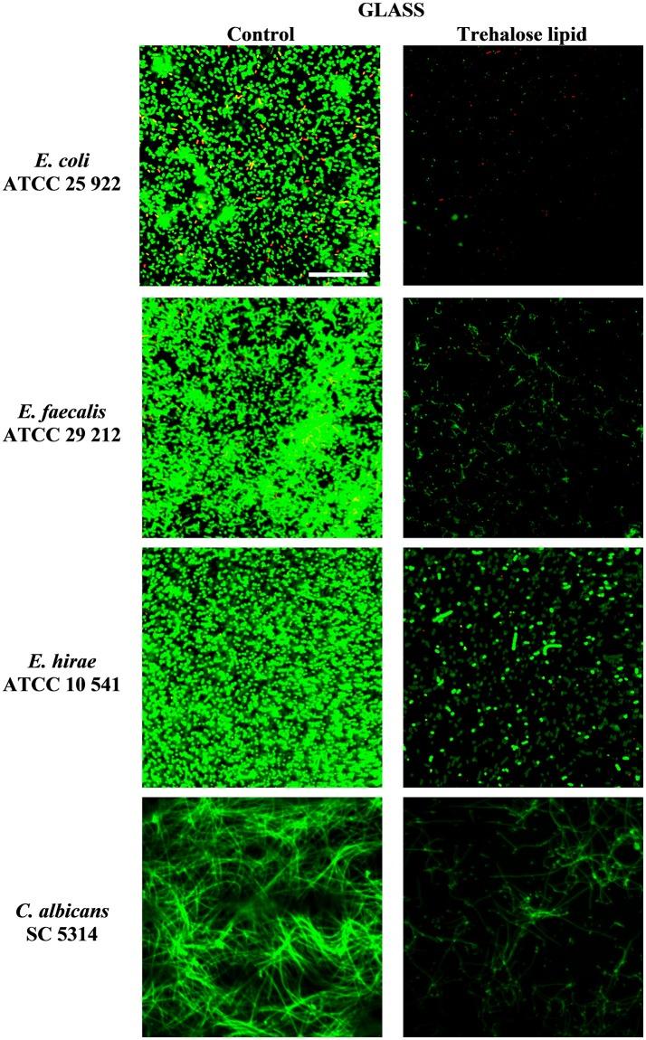 https://cdn.ncbi.nlm.nih.gov/pmc/blobs/987e/6198247/9a54cb3b08fe/fmicb-09-02441-g0004.jpg