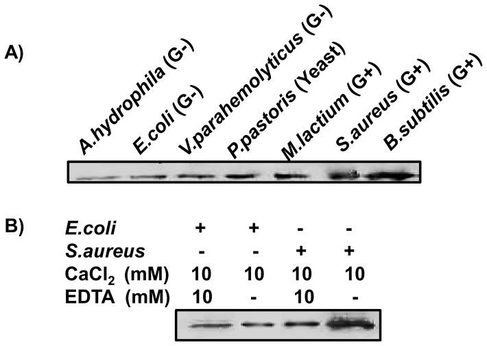 https://cdn.ncbi.nlm.nih.gov/pmc/blobs/987f/3795701/a8f31ca528b7/pone.0076132.g004.jpg