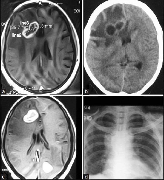 https://cdn.ncbi.nlm.nih.gov/pmc/blobs/9880/4129578/5c1a7b23413a/AJNS-9-58-g001.jpg