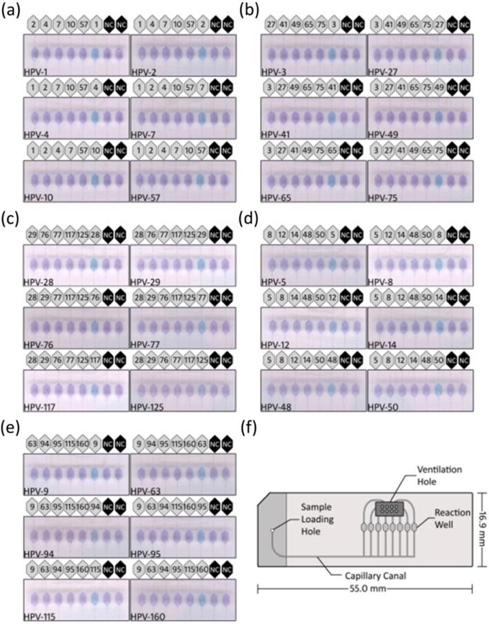 https://cdn.ncbi.nlm.nih.gov/pmc/blobs/9884/7346499/b99a43cb9aef/12985_2020_1373_Fig1_HTML.jpg